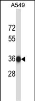 NAPB (N-term)