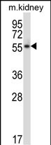 Mouse Plk5 (N-term)