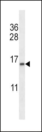 TCEB2