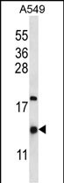 HIGD2A (N-term)
