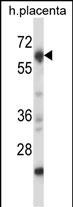 Mouse Nrbp2