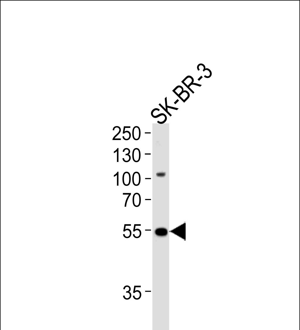 SMARCE1