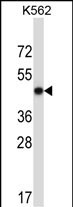 METAP2 (N-term)