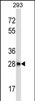 CTDSP2 (N-term)