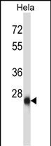 ZIC4 (N-term)