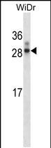 Rat Hoxa7 (N-term)