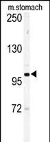 Eph Receptor A6
