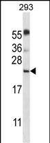 SFTPA1B