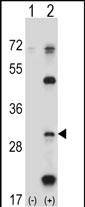 Rabbit Polyclonal Antibody to PSMB5