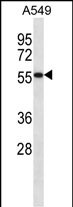 SEMG1 (N-term)