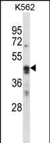 ARC (N-term)
