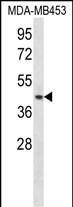 RING1 (N-term)