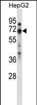 ZNF395