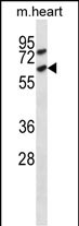 Mouse Acvr1c
