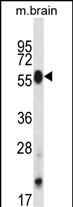 Mouse Clk4 (N-term)