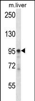 PLCD3 (N-term)