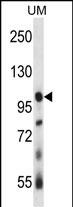 USP4 (N-term)