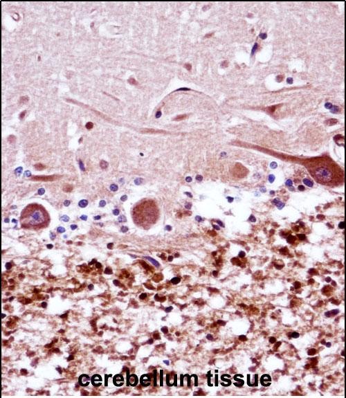 Rabbit Polyclonal Antibody to FANCG