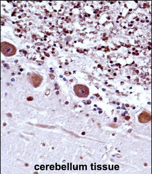 Rabbit Polyclonal Antibody to TRA2B