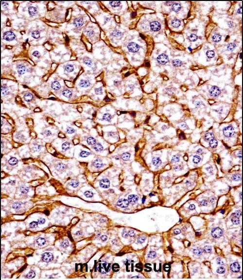 Rabbit Polyclonal Antibody to Mouse Eif2ak4