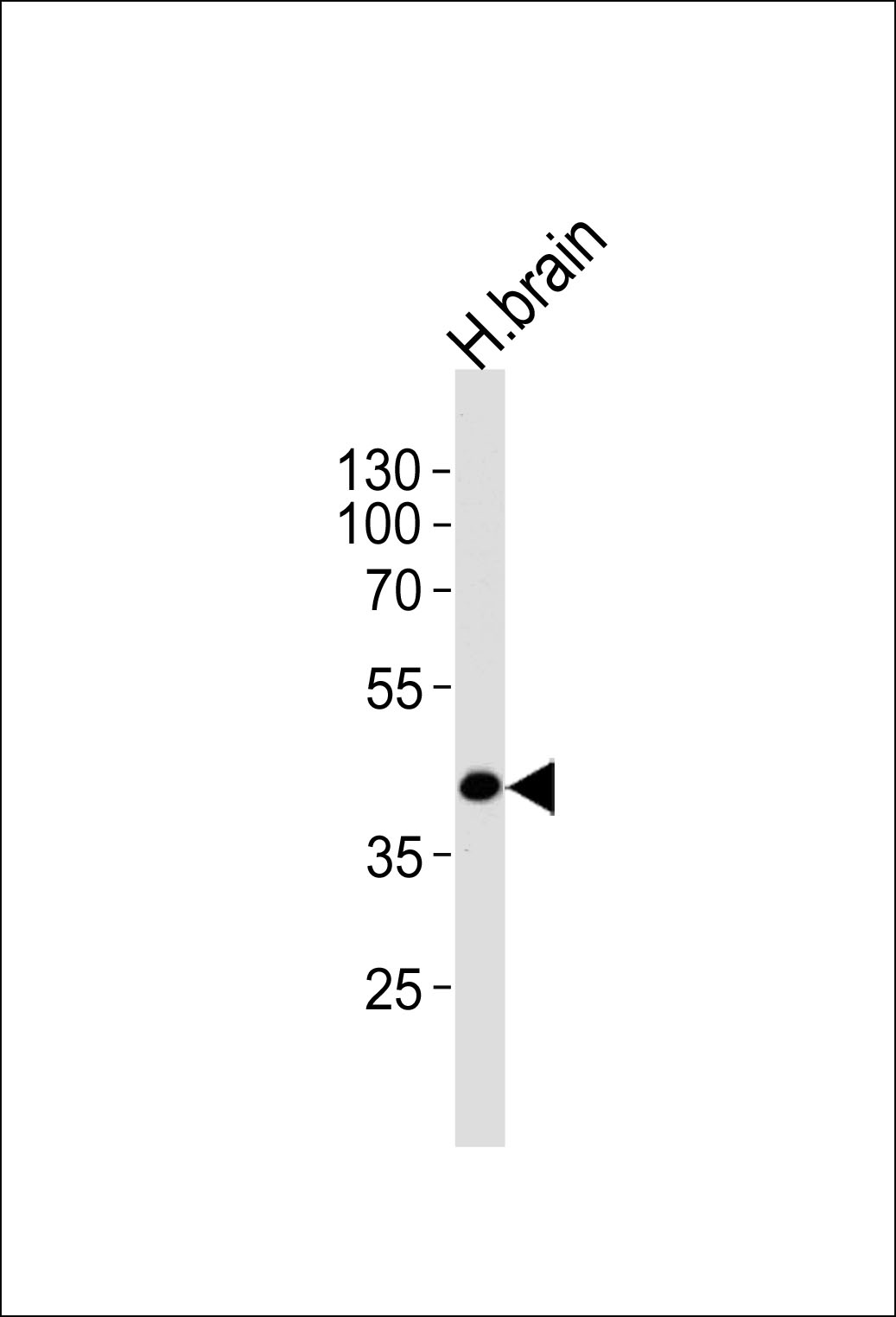SEPT5 (N-term)
