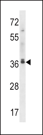 MAPRE2 (N-term)