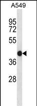 ACTA1/Alpha-actin
