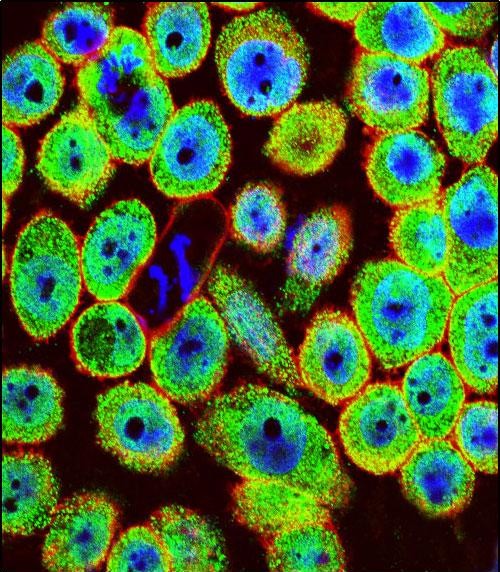 Rabbit Polyclonal Antibody to HN1