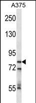CPSF3