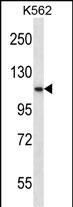 PCSK6