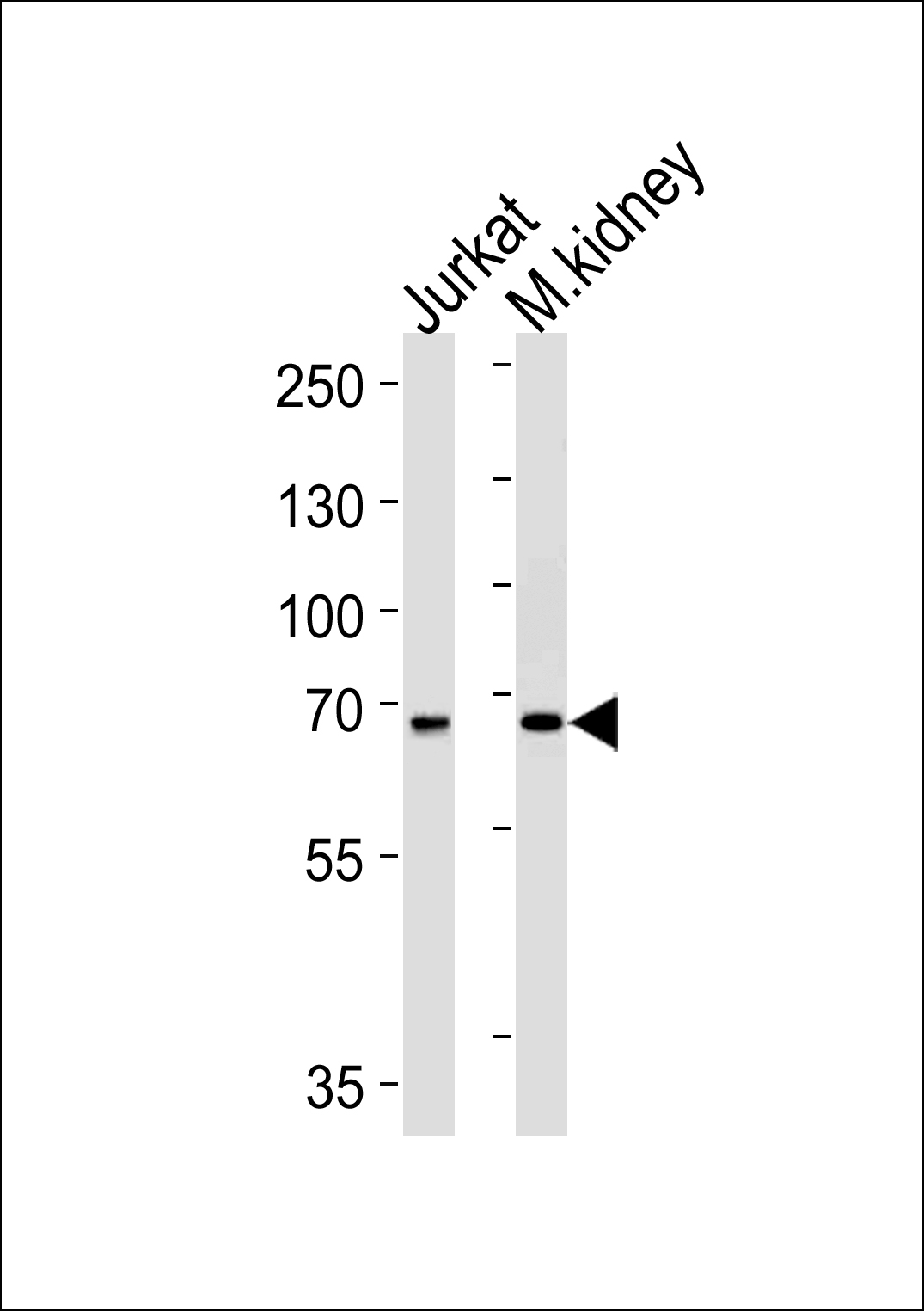 TCF12 (N-term)