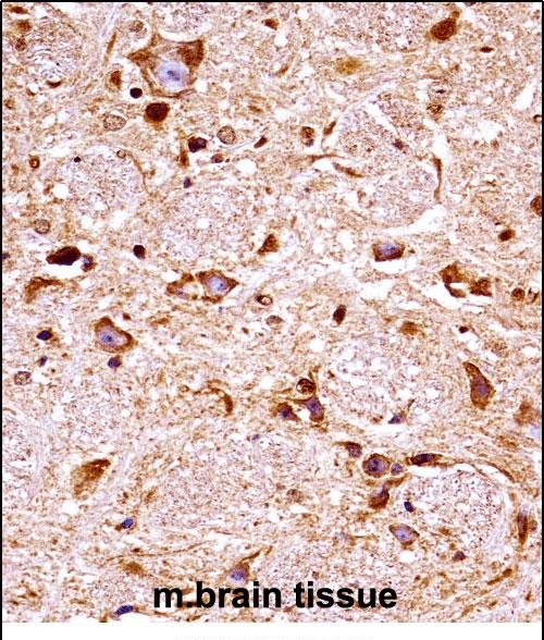 Rabbit Polyclonal Antibody to Mouse Fgfr3