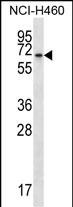 BEND4 (N-term)