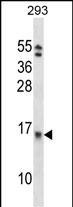 EIF1B
