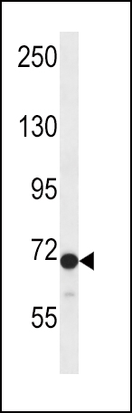 DVL2