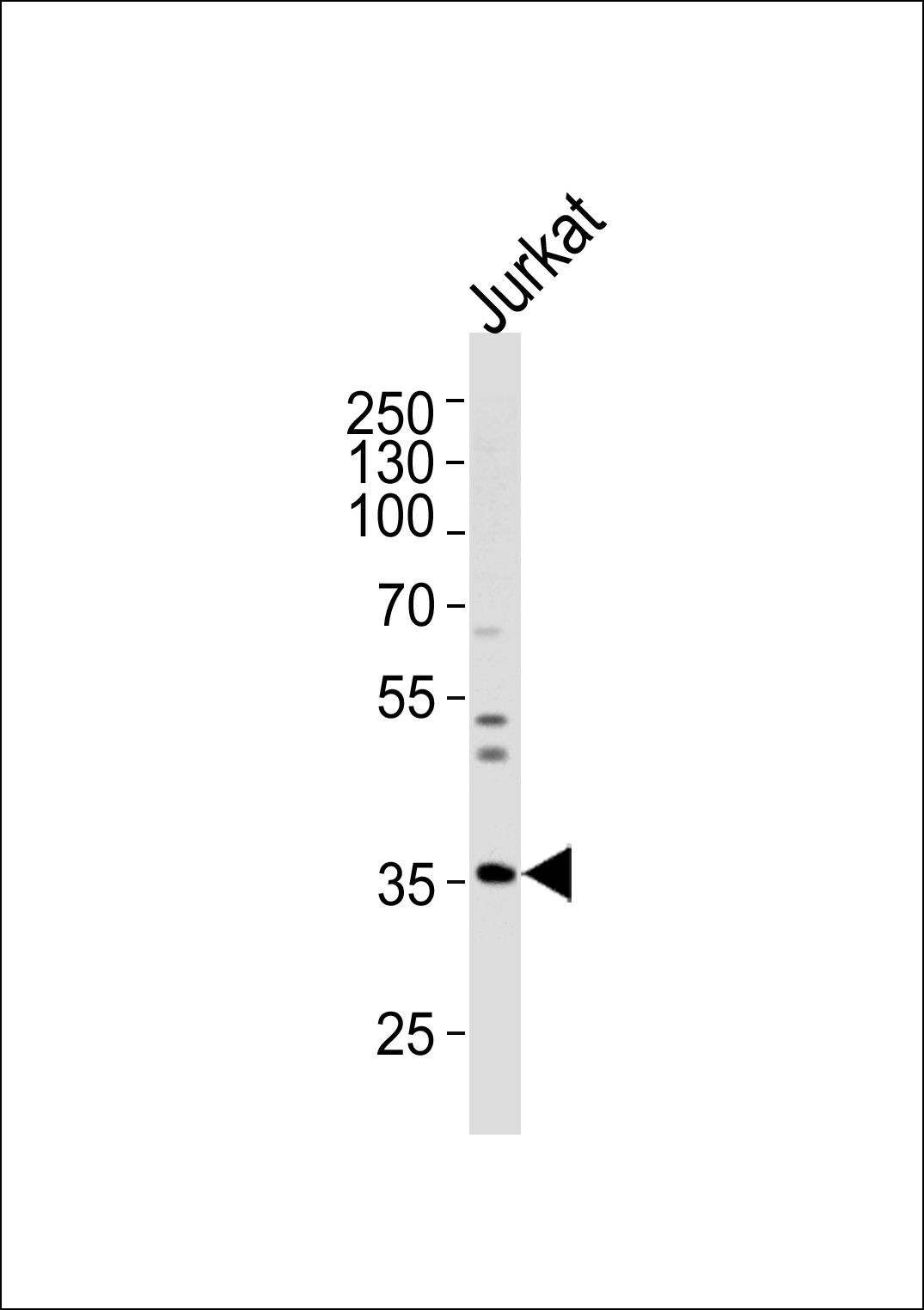 GLRB (N-term)