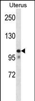 MOV10 (N-term)