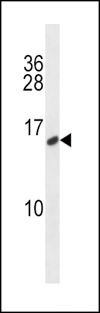 CALCA/CT