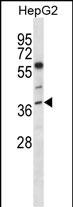 NEIL2 (N-term)