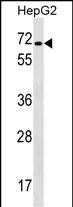CACNB1