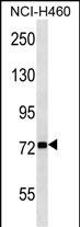ZNF441 (N-term)
