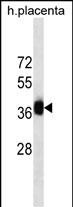 GBX2(Ascites)