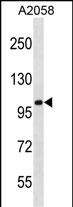 CCDC46 (N-term)