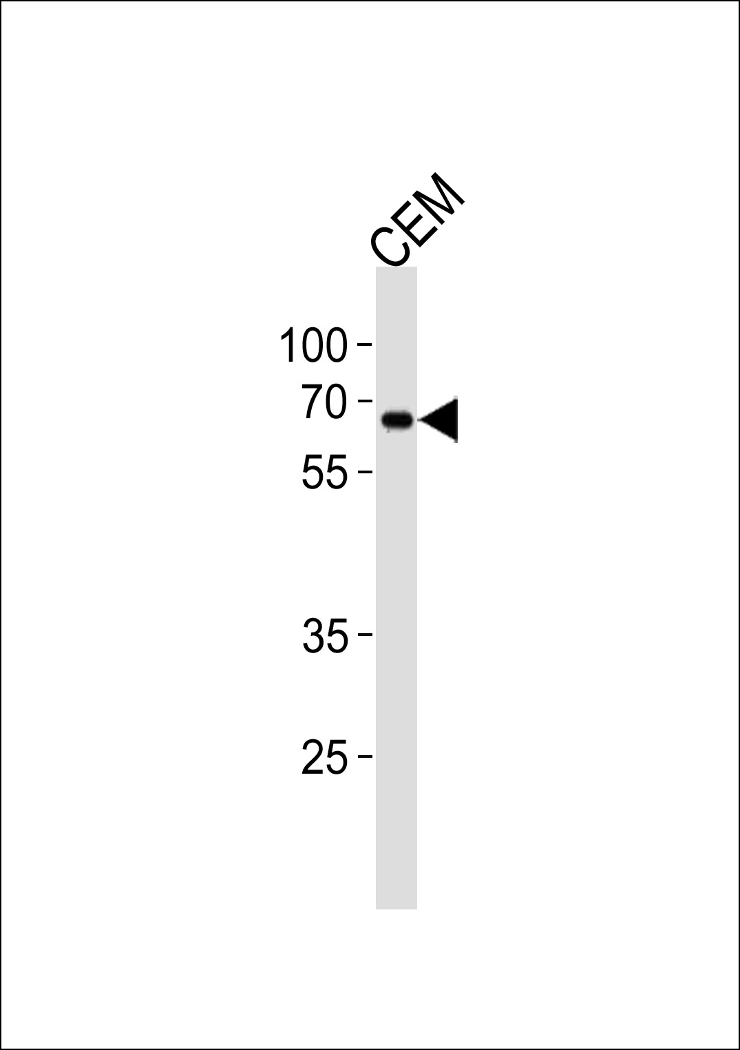ZNF90
