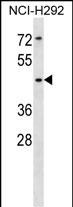 SIGLEC14 (N-term)