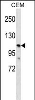 PKD2L1 (N-term)