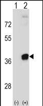 Rabbit Polyclonal Antibody to PRPS2