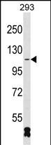 RBM26 (N-term)