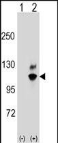 Rabbit Polyclonal Antibody to GNL2 (N-term)