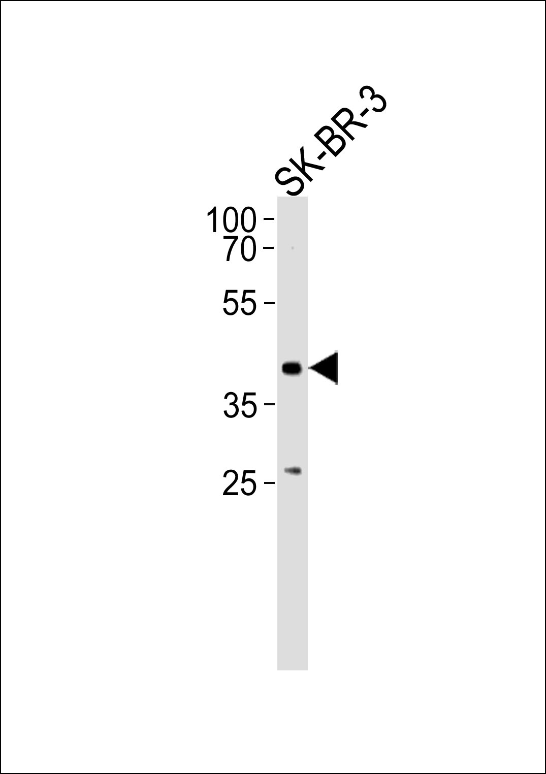 ELK3 (N-term)